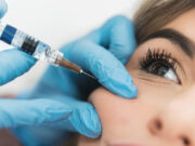 Тонкости применения филлеров в косметологии