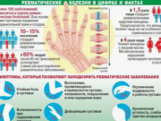 Ревматические заболевания: нестандартные решения в терапии