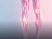 Современное лечение варикоза без операции