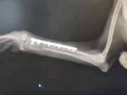 Современные методы остеосинтеза переломов предплечья