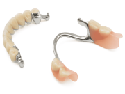 Бюгельные протезы: понятный гид по удобному решению для зубного ряда