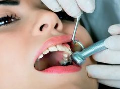 Лечение кариеса: современные подходы, которые вернут зубам здоровье