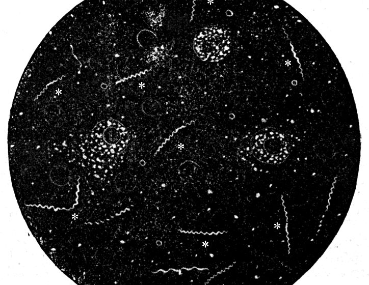 Темнопольные микроскопы: оборудование для собственной лаборатории