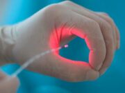 Лазерные технологии в комплексном лечении геморроя