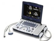 УЗИ аппарат General Electric Logiq V2: особенности и преимущества